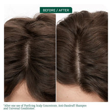 Load image into Gallery viewer, Matrix Biolage Scalp Sync Pyrithione Zinc Antidandruff Shampoo
