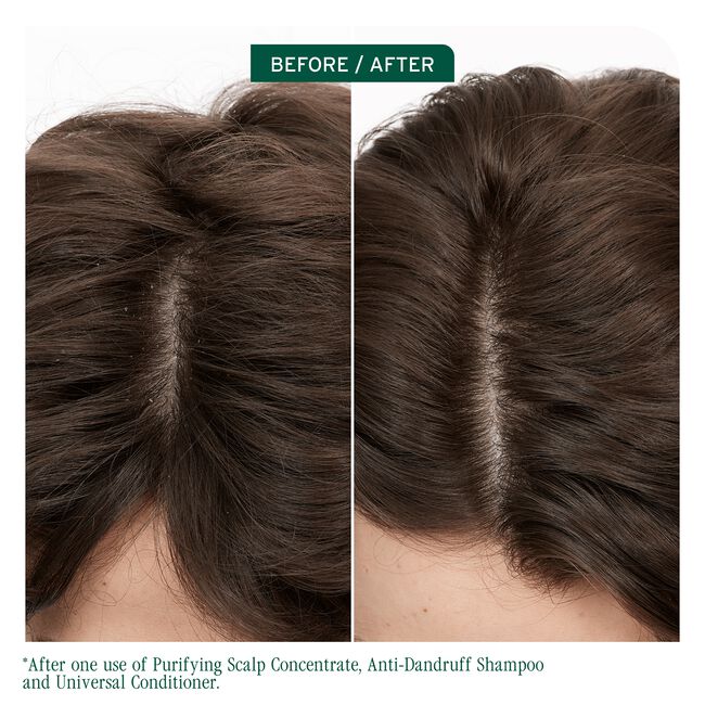 Matrix Biolage Scalp Sync Pyrithione Zinc Antidandruff Shampoo